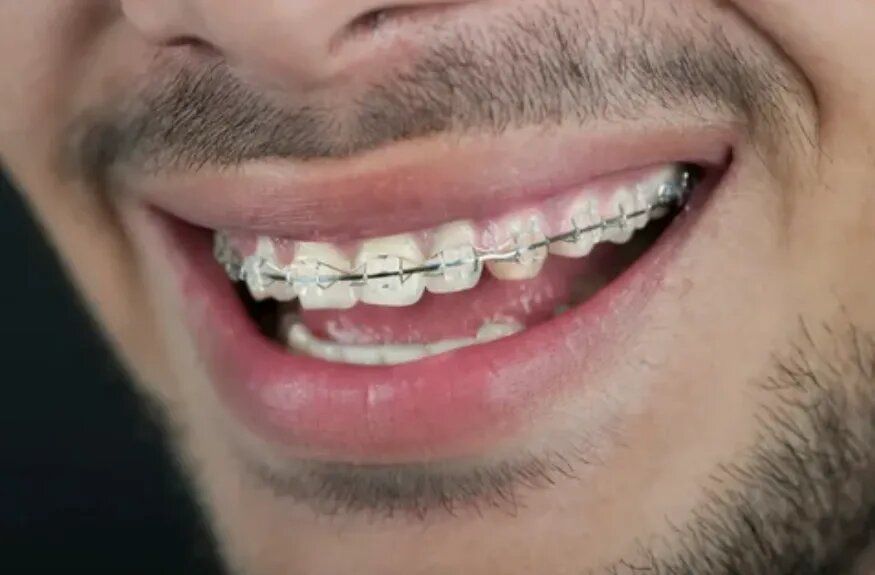   :      