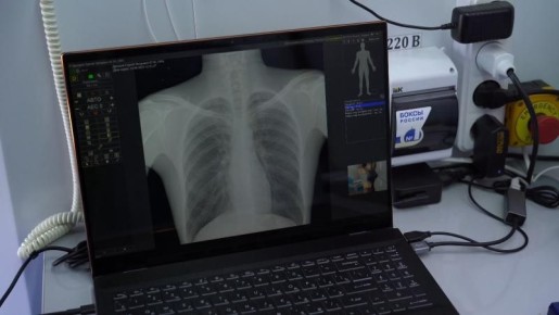 Специалисты советуют камчатцам знать свои показатели здоровья