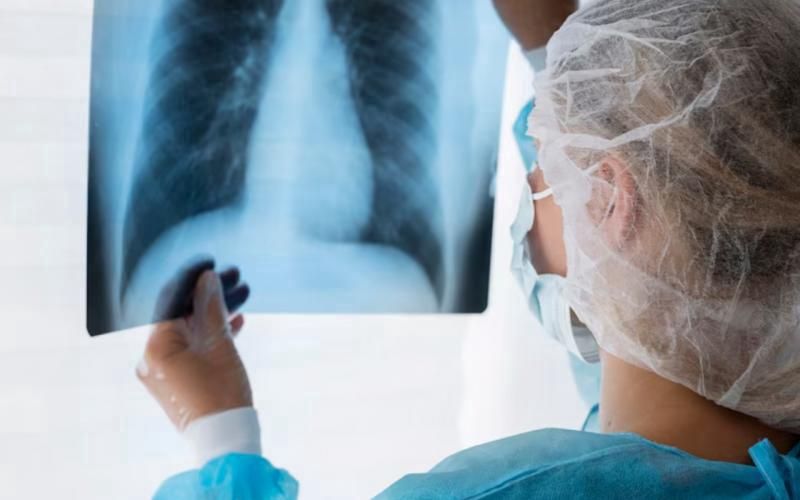 Как выглядит рак легких на рентгене: камчатские медики информируют