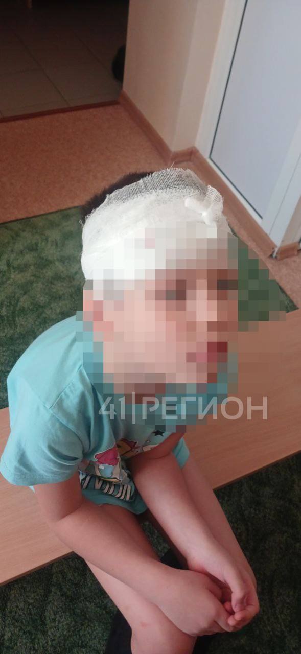 Ребенок получил травму головы, а родители остались в неведении