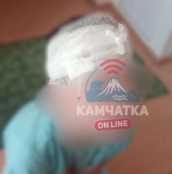 Ребёнок получил травму в детском саду и ждал не скорую помощь, а маму