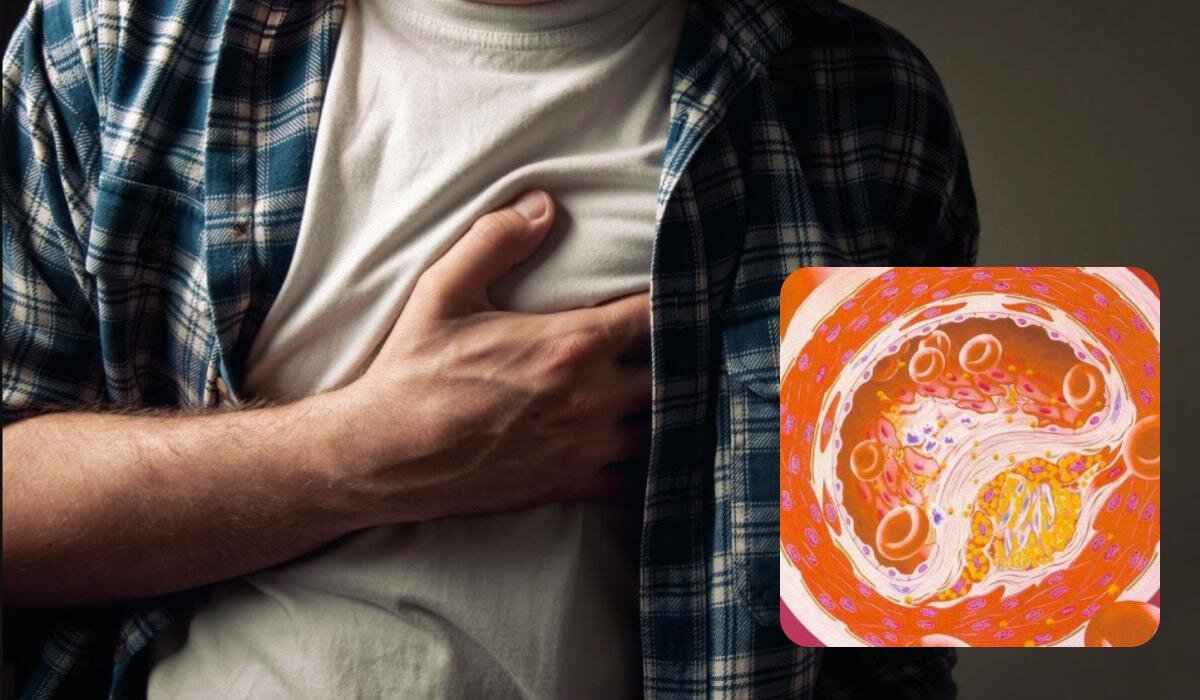 Что стоит исключить из рациона для здоровья артерий