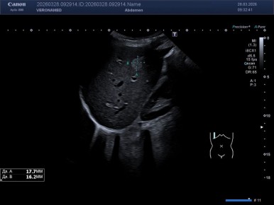 ���������� ������: ������ ��� ������� � ������ �����