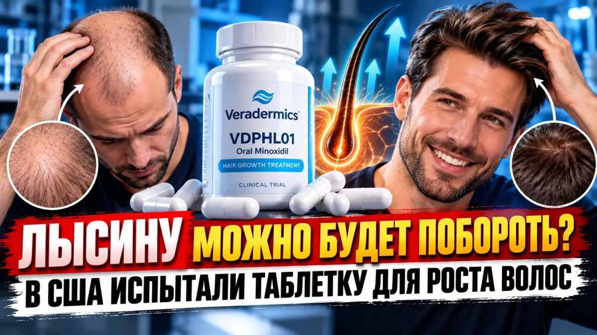 ЛЫСИНУ МОЖНО БУДЕТ ПОБОРОТЬ? В США ИСПЫТАЛИ ТАБЛЕТКУ ДЛЯ РОСТА ВОЛОС